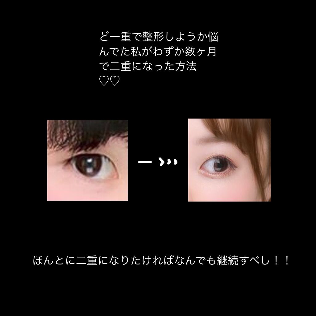 ナイトアイボーテ/StreeTrend/二重まぶた用アイテムを使ったクチコミ（1枚目）