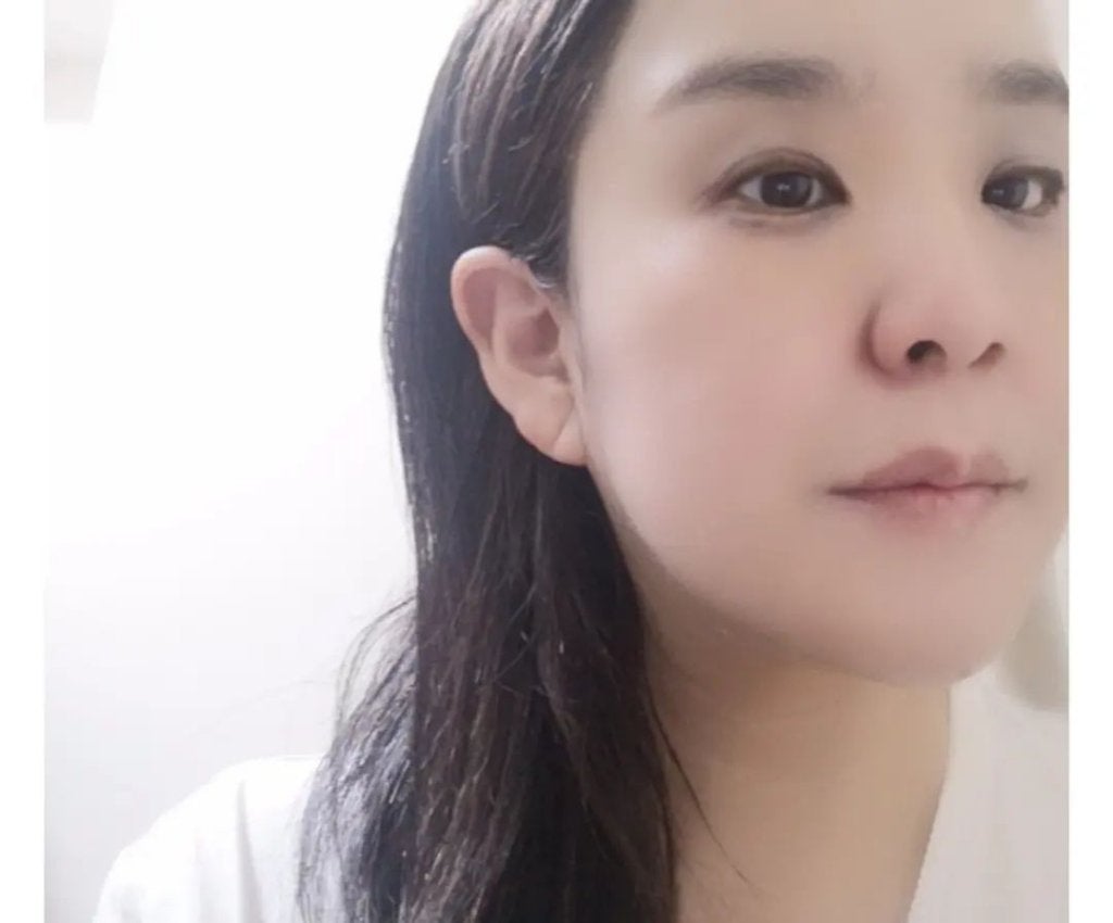 アルファラディアンスグローセラム/BANOBAGI/美容液を使ったクチコミ(5枚目)