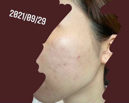 を使ったクチコミ(1枚目)