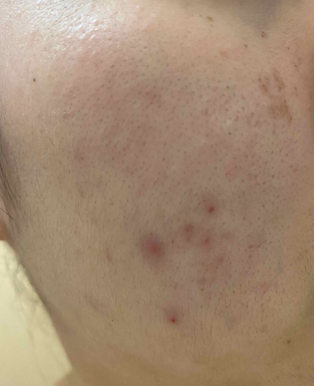 Cセラム/b.glen/美容液を使ったクチコミ(2枚目)