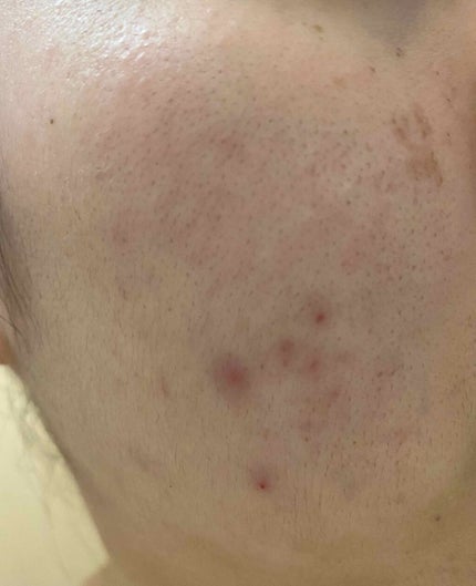 Cセラム/b.glen/美容液を使ったクチコミ(2枚目)