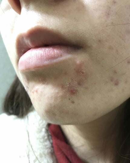 を使ったクチコミ(3枚目)