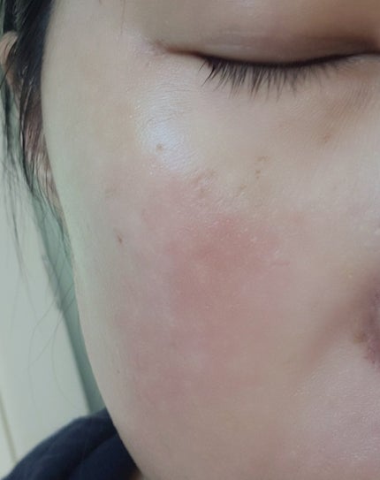 ユース ラディアンス ビタチノール セラム/primera/美容液を使ったクチコミ(6枚目)