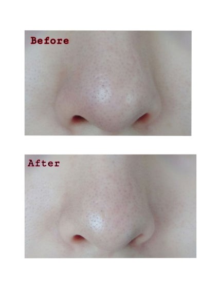 JUSO KURO PACK/NAKUNA-RE/洗い流すパック・マスクを使ったクチコミ(4枚目)