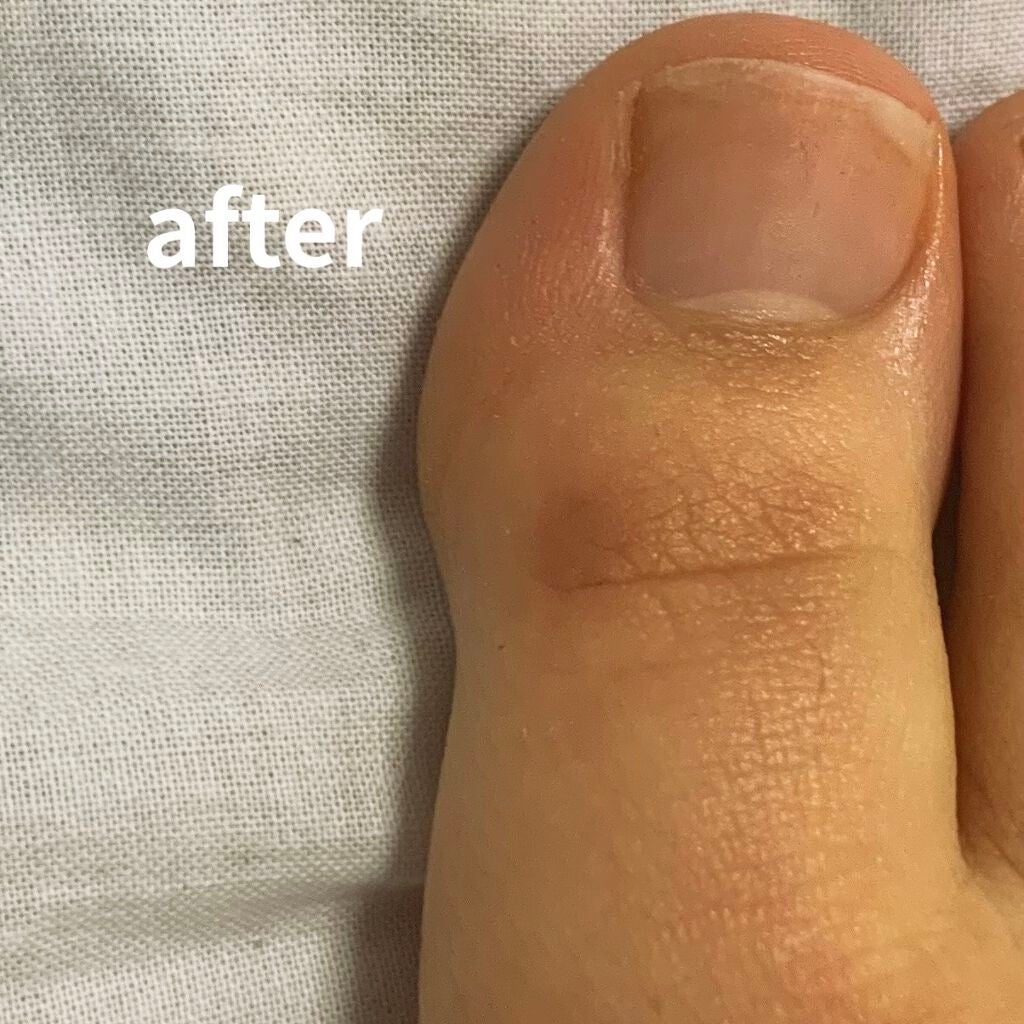 ネイルケアオイル/無印良品/ネイルオイル・トリートメントを使ったクチコミ(4枚目)