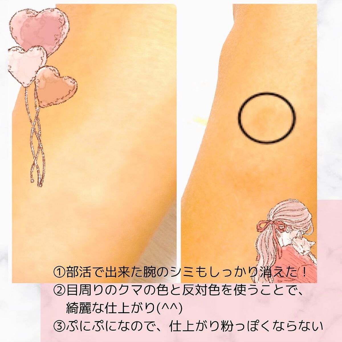 フーミー キニシーラー/WHOMEE/パレットコンシーラーを使ったクチコミ(3枚目)