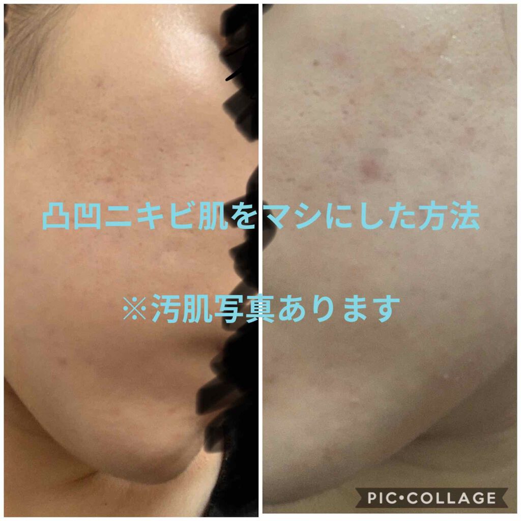 クラリファイング ローション 3/CLINIQUE/拭き取り化粧水を使ったクチコミ（1枚目）