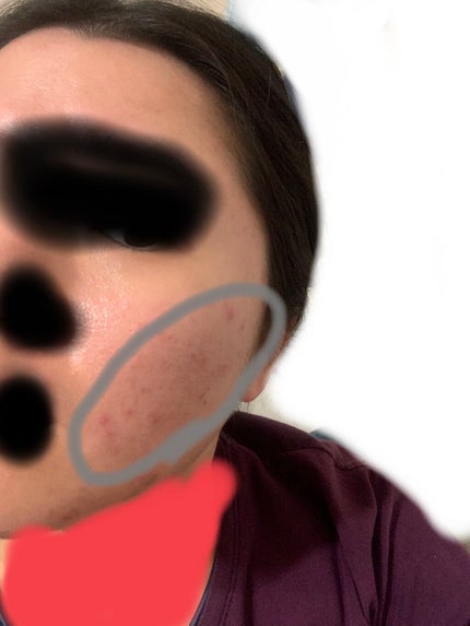 クエン酸(結晶)/健栄製薬/その他を使ったクチコミ(1枚目)