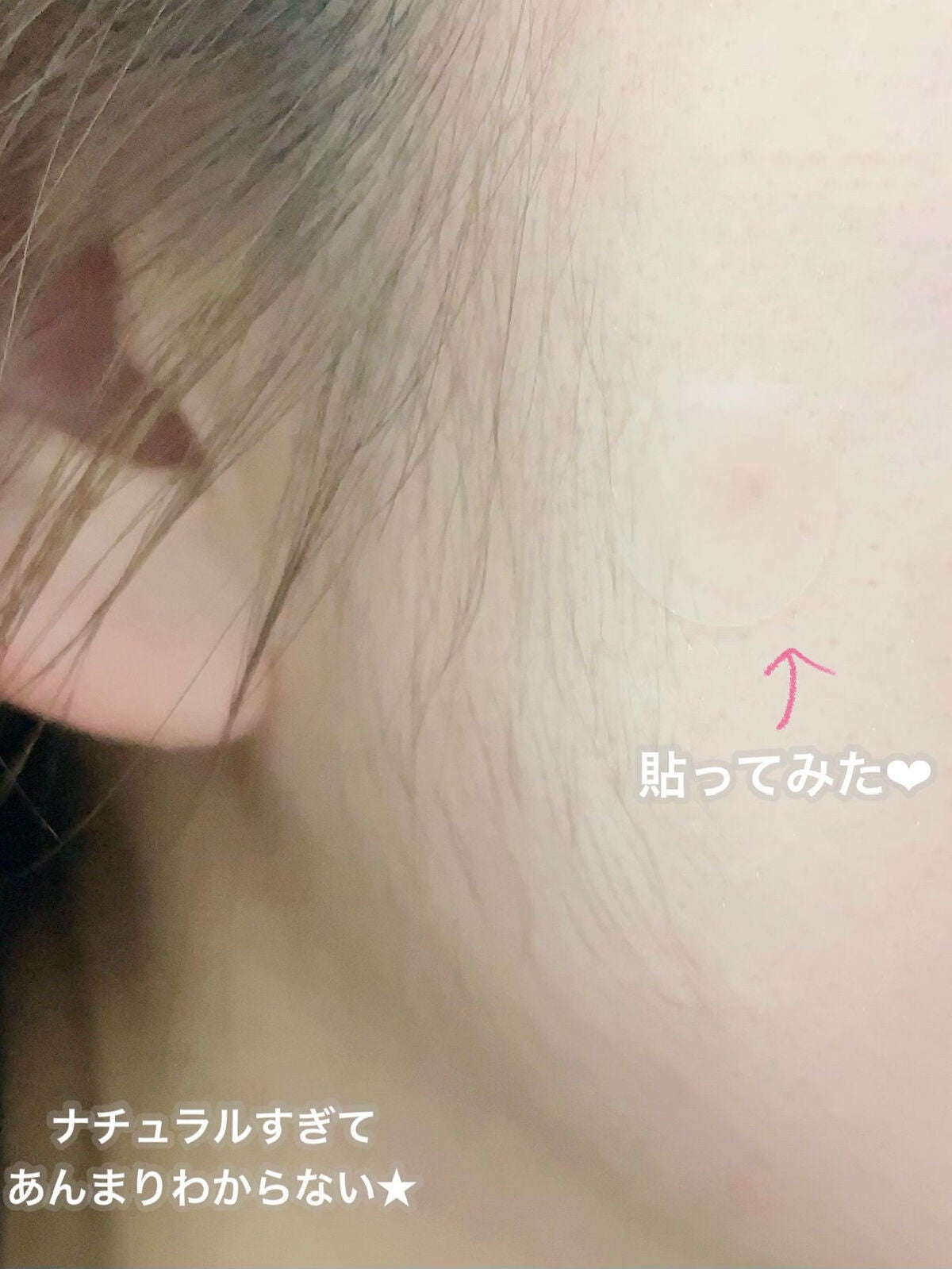 プロCICA クリアスポットパッチ/VT/その他スキンケアを使ったクチコミ(4枚目)