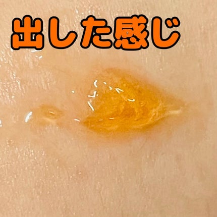 ザ セラム マルチチューン/アスタリフト/美容液を使ったクチコミ(2枚目)