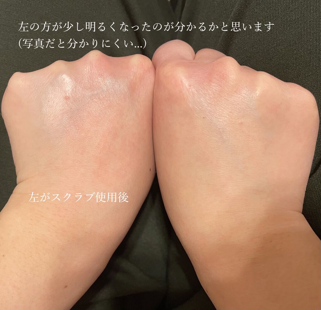 ブラックシュガー パーフェクト エッセンシャル スクラブ2X/SKINFOOD/洗い流すパック・マスクを使ったクチコミ(4枚目)