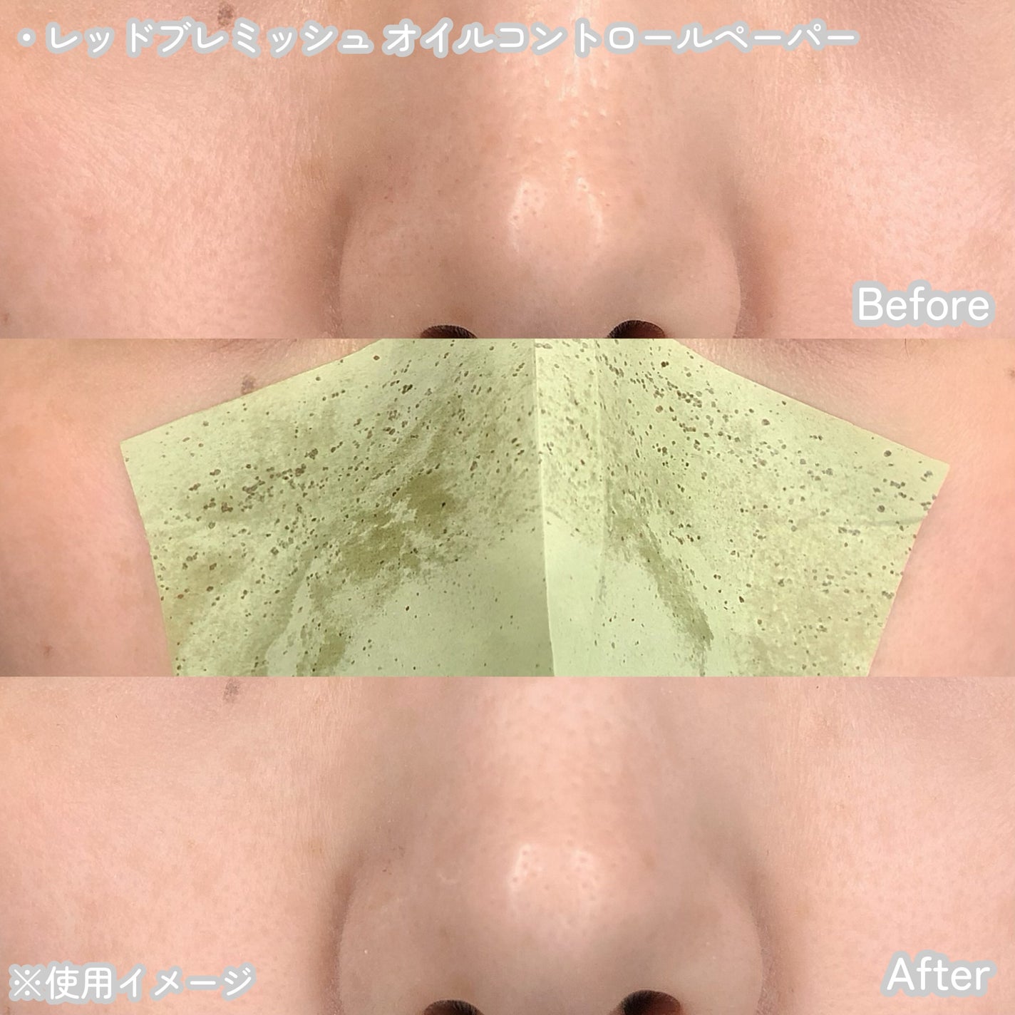 Dr.G Aクリアスポットパッチ/Dr.G/その他スキンケアを使ったクチコミ(3枚目)