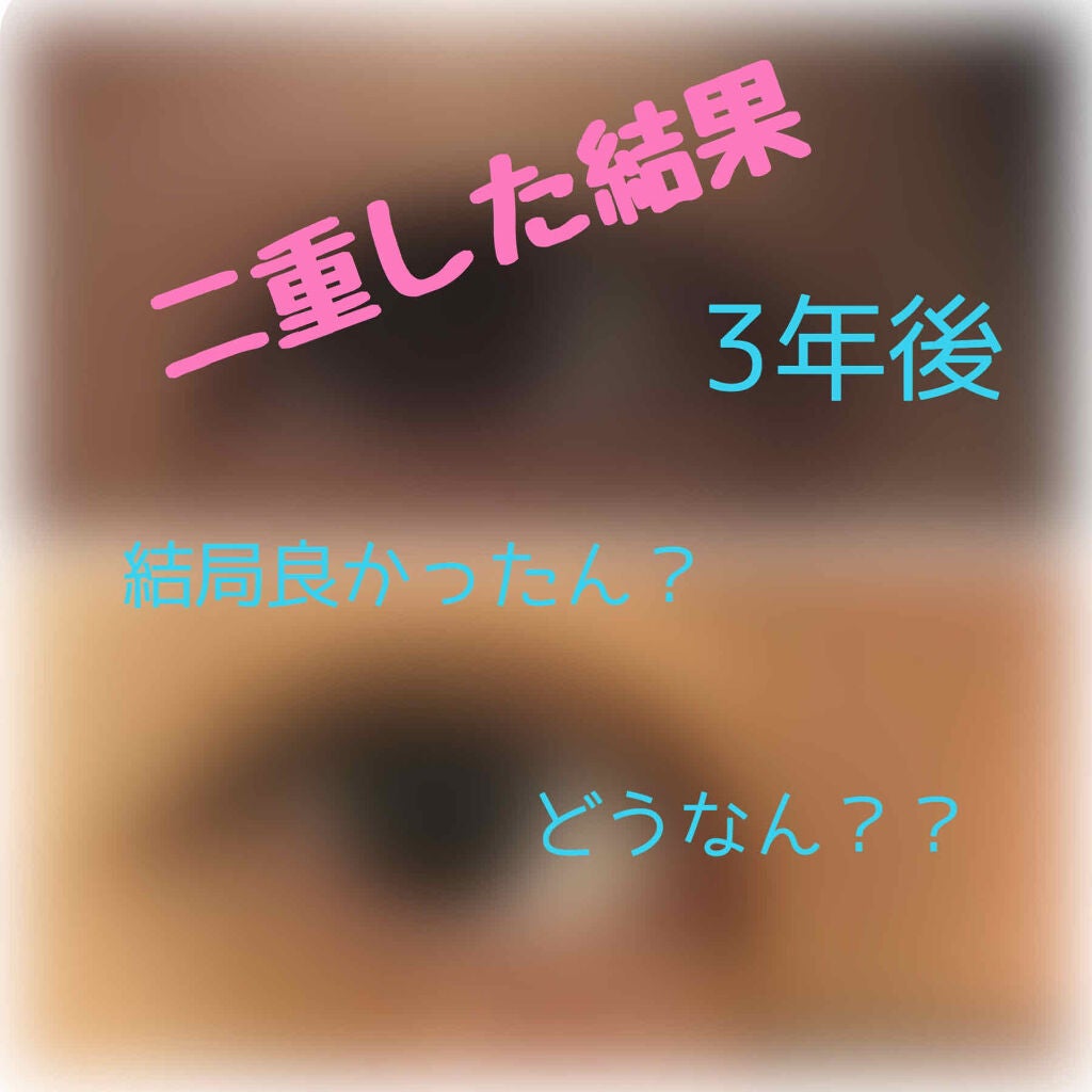 みるく on LIPS 「今回は、、、私が二重にしたことを書こうと思います。と言ってもだ..」(1枚目)
