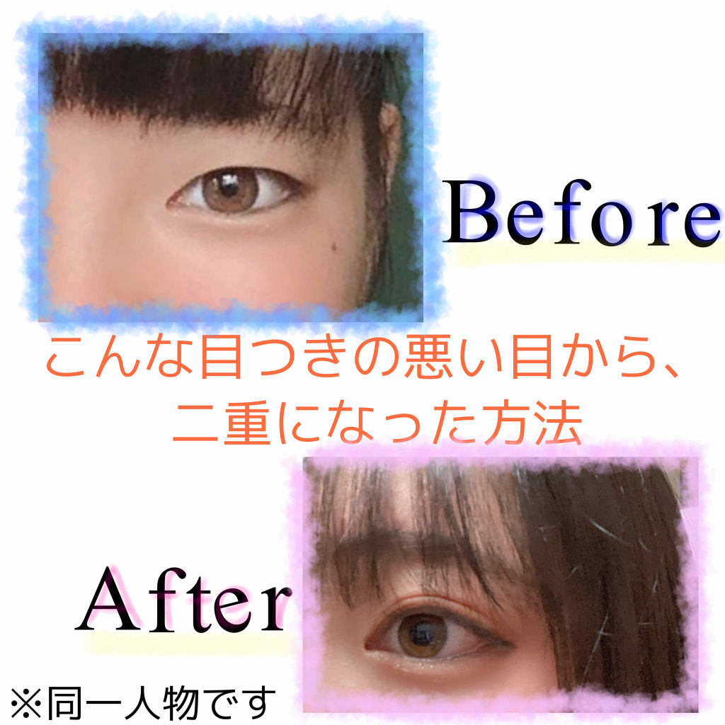 のびーるアイテープ（絆創膏タイプ、レギュラー）/DAISO/二重まぶた用アイテムを使ったクチコミ（1枚目）