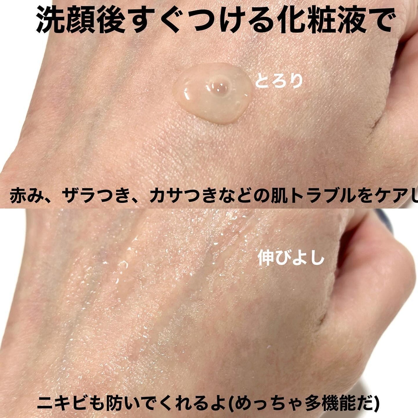 トラブルリペア リキッド/アルージェ/美容液を使ったクチコミ(3枚目)