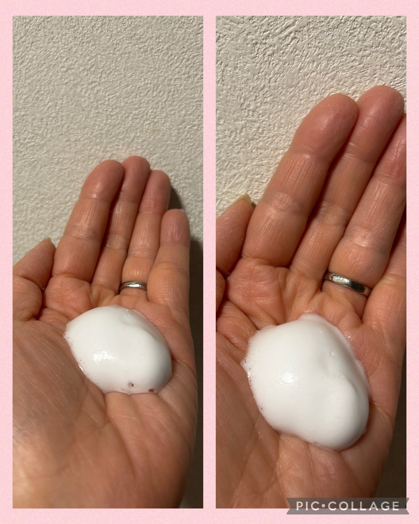 フェルゼアプレミアム 薬用泡の化粧水/フェルゼア/化粧水を使ったクチコミ(4枚目)