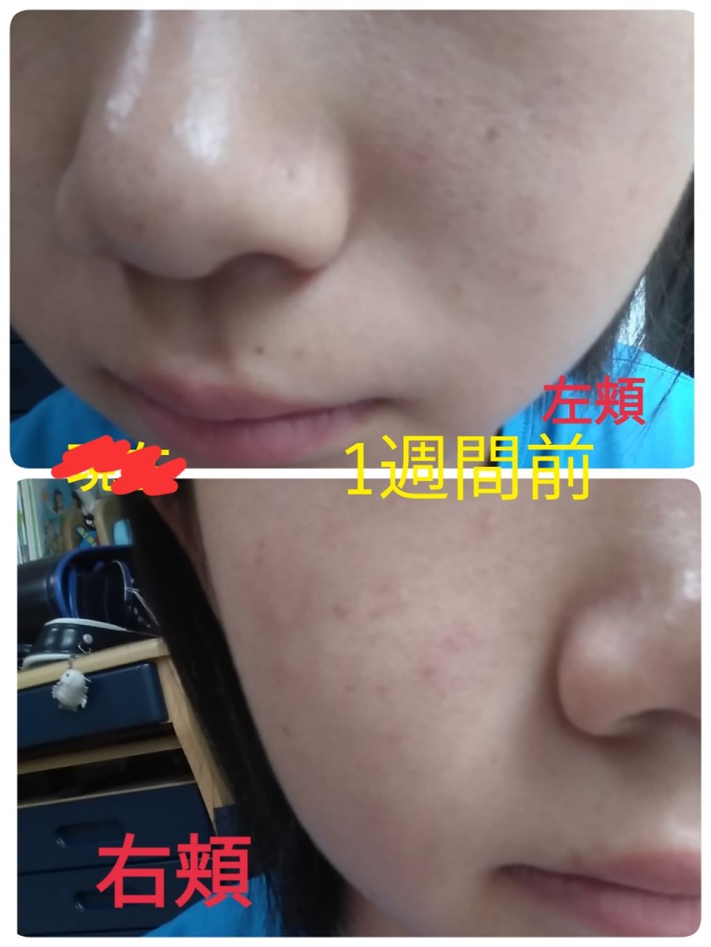 DHC ビタミンＣハードカプセル/DHC/美容サプリメントを使ったクチコミ（3枚目）