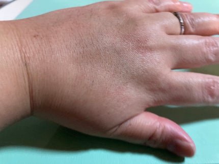 プロバイオシカ インテンシブ アンプル/SKIN1004/美容液を使ったクチコミ(4枚目)