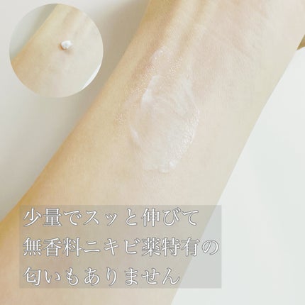 マキロン アクネージュ メディカルクリーム (医薬品) /マキロン/その他を使ったクチコミ(4枚目)