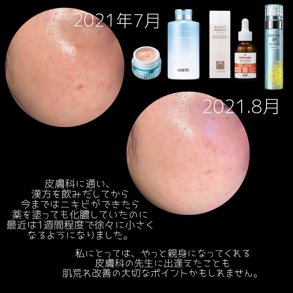 モイストバランス ローション/ACSEINE/化粧水を使ったクチコミ(7枚目)