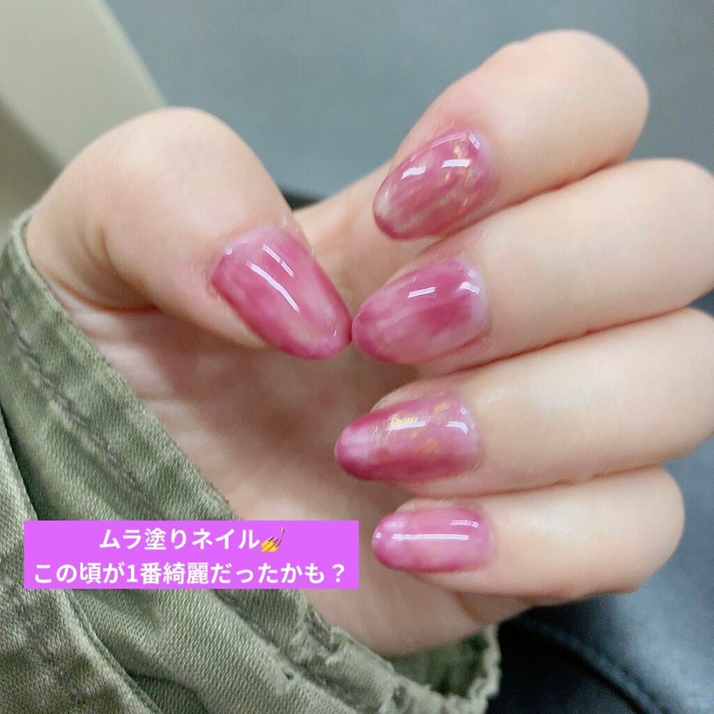 さ on LIPS 「深爪・チビ爪矯正日記🤞私自身ずっと爪を噛むクセがあって大学入っ..」(6枚目)