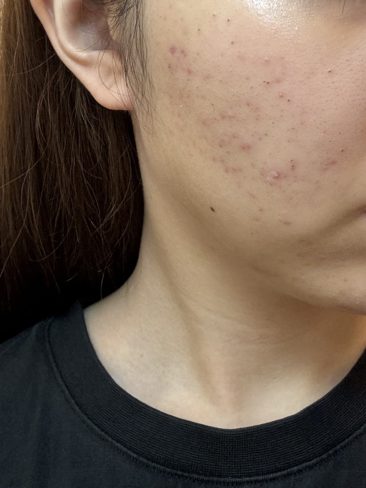 浸透湿潤セラミド１０％★ナノエマルジョン/TOUT VERT/乳液を使ったクチコミ（1枚目）