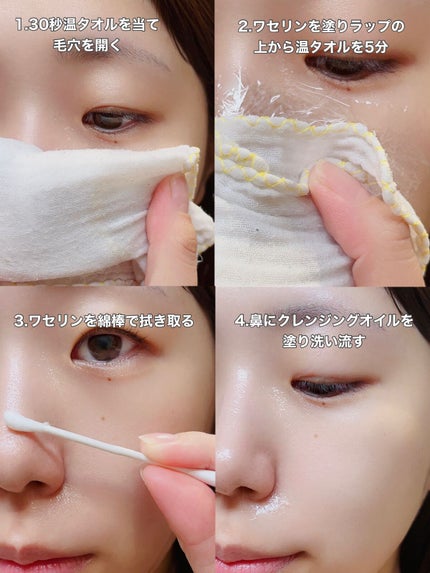 オリジナル ピュアスキンジェリー/ヴァセリン/ボディクリームを使ったクチコミ(2枚目)