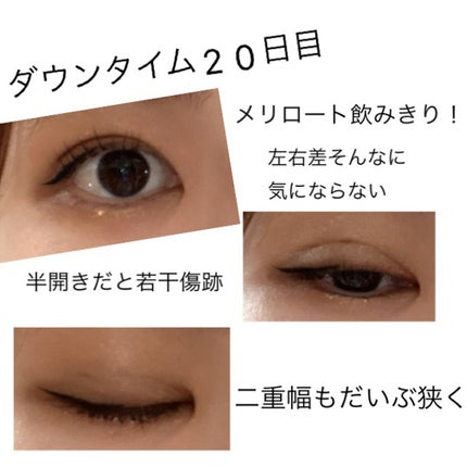 DHC メリロート/DHC/ボディサプリメントを使ったクチコミ(1枚目)