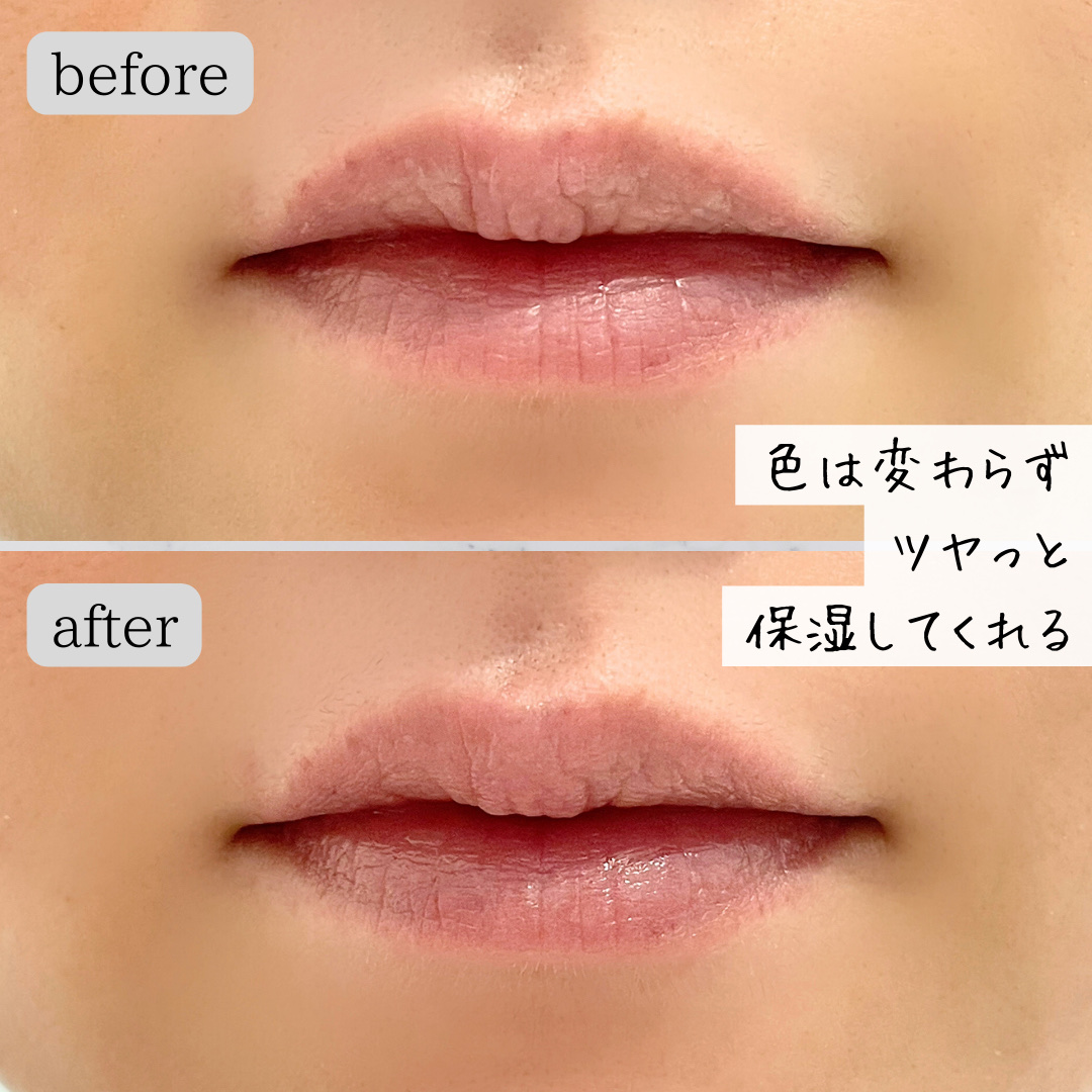タカミリップ/タカミ/リップ美容液を使ったクチコミ（3枚目）