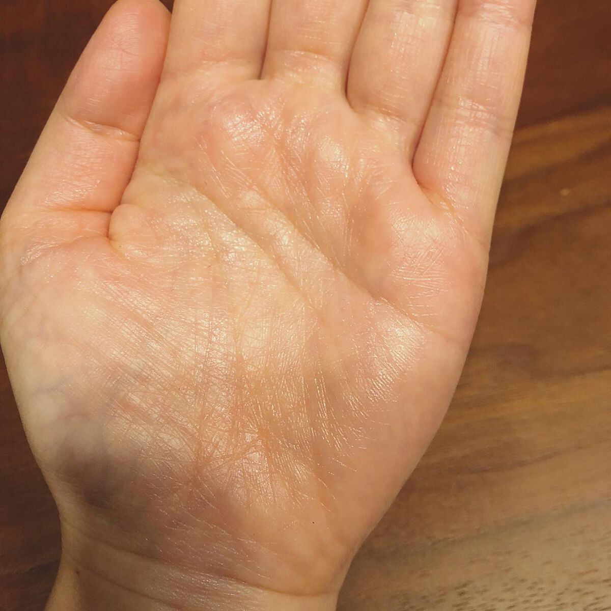 ステムトリートメント デュアルリペアセラム/Reinca/美容液を使ったクチコミ(8枚目)