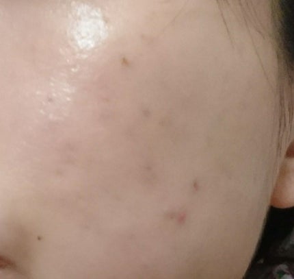 プロポリス エネルギーアンプル/CNP Laboratory/美容液を使ったクチコミ(2枚目)