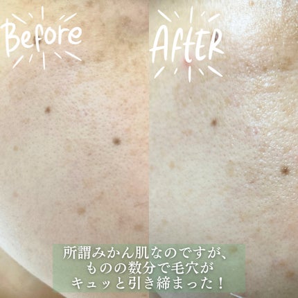 ポストアルファシカクーリングパッド/Cell Fusion C(セルフュージョンシー)/トナーパッドを使ったクチコミ(6枚目)