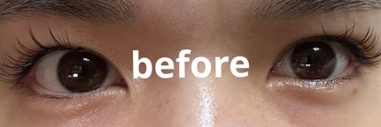 TWOOL ダブルアイリッドグルー/SHOBIDO/二重まぶた用アイテムを使ったクチコミ(1枚目)