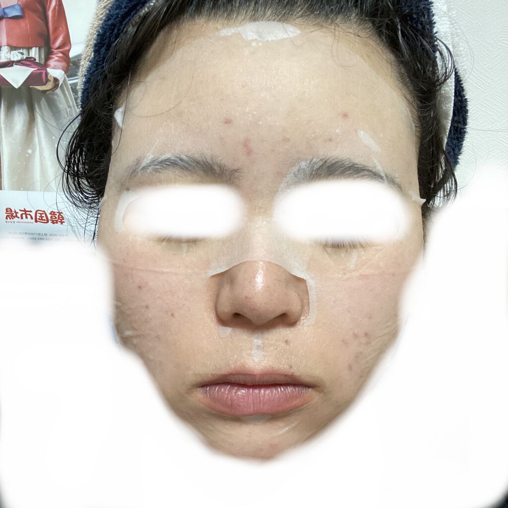 CICA エマルジョン/VT/乳液を使ったクチコミ（3枚目）