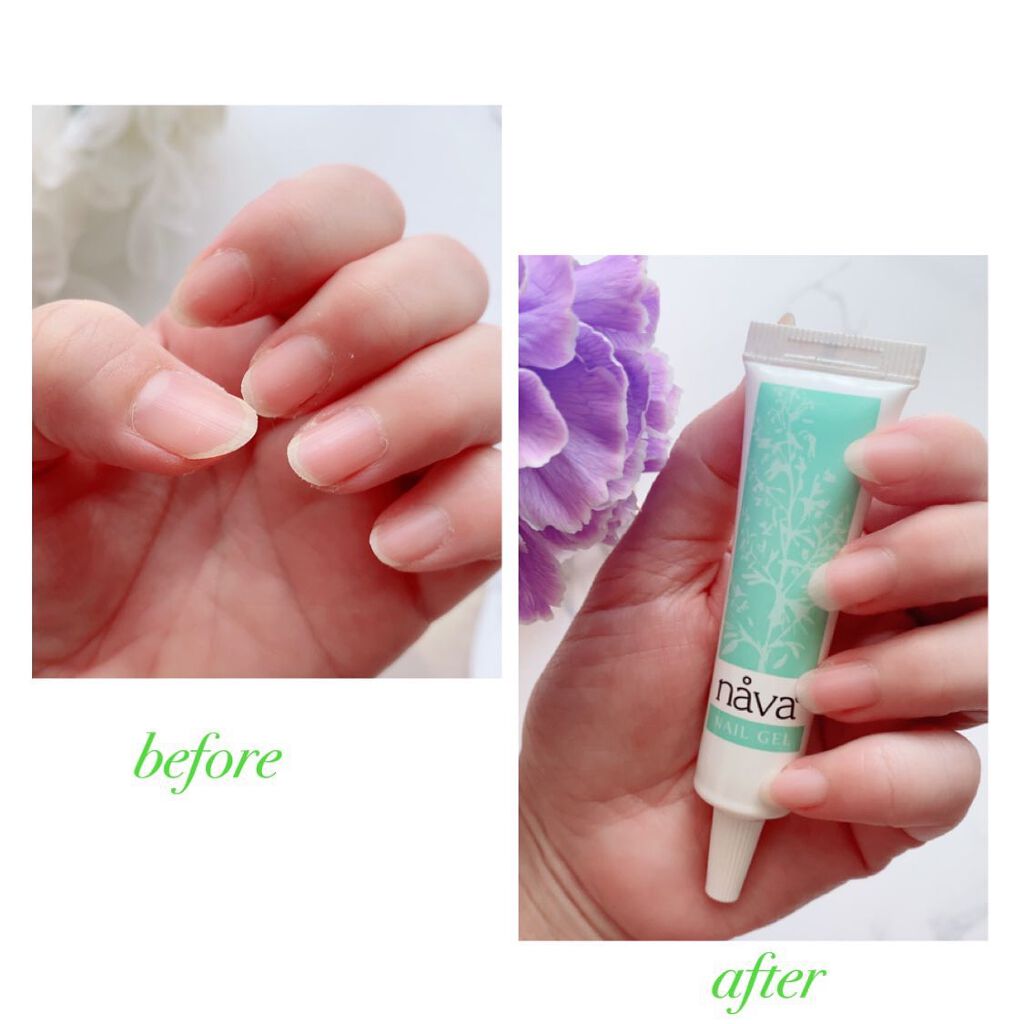 爪用ジェル nava(ナーバ)/ベリタス/ネイルオイル・トリートメントを使ったクチコミ(4枚目)