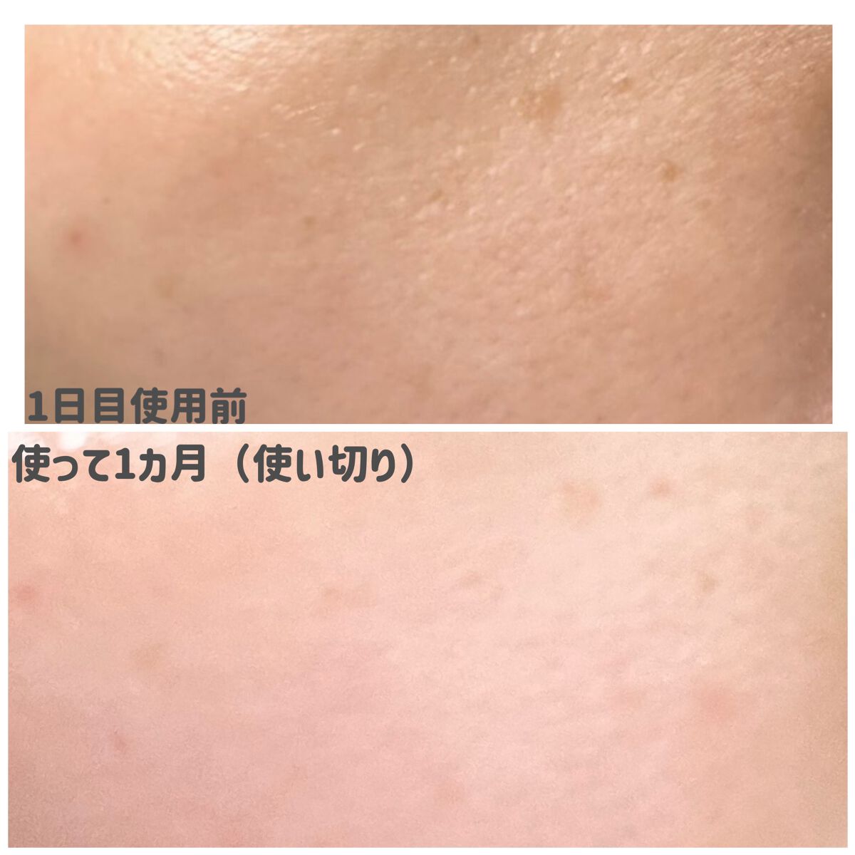 ヘデラヘリックス デイリー&クイック スージングマスク/Milk Touch/シートマスク・パックを使ったクチコミ(6枚目)