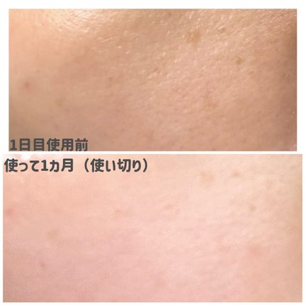 ヘデラヘリックス デイリー&クイック スージングマスク/Milk Touch/シートマスク・パックを使ったクチコミ(6枚目)