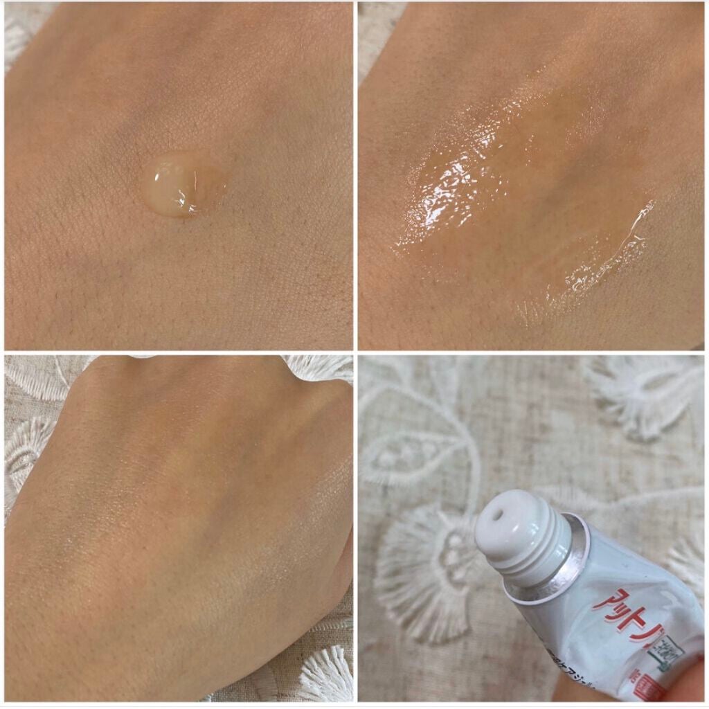 ニキビあとケアジェル/アットノン/その他スキンケアを使ったクチコミ(3枚目)