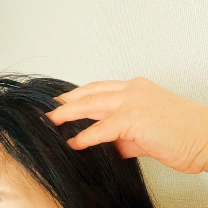 薬用 RJ地肌ケア エッセンス /アピセラピーコスメティクス/頭皮ローションを使ったクチコミ(9枚目)