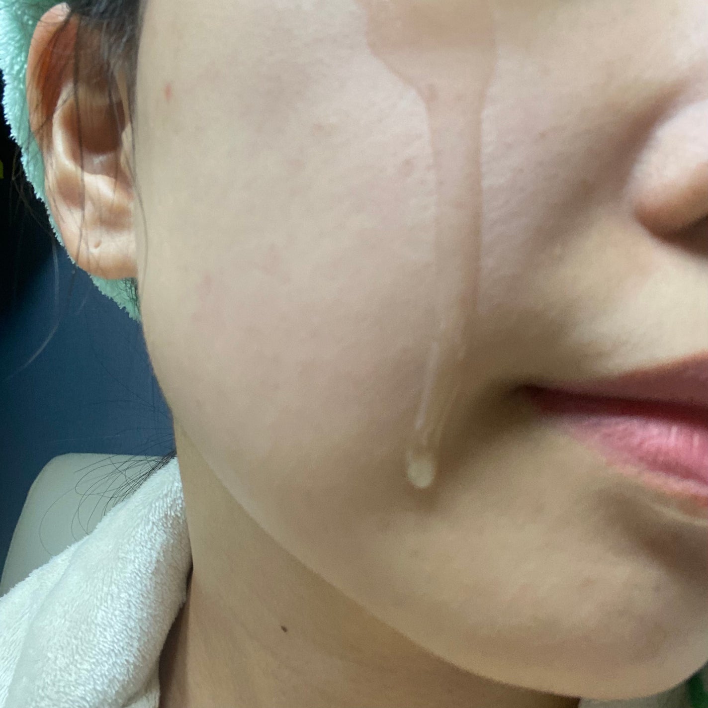 ダーマテカバイオームトナー/THE A'VVE/化粧水を使ったクチコミ(3枚目)