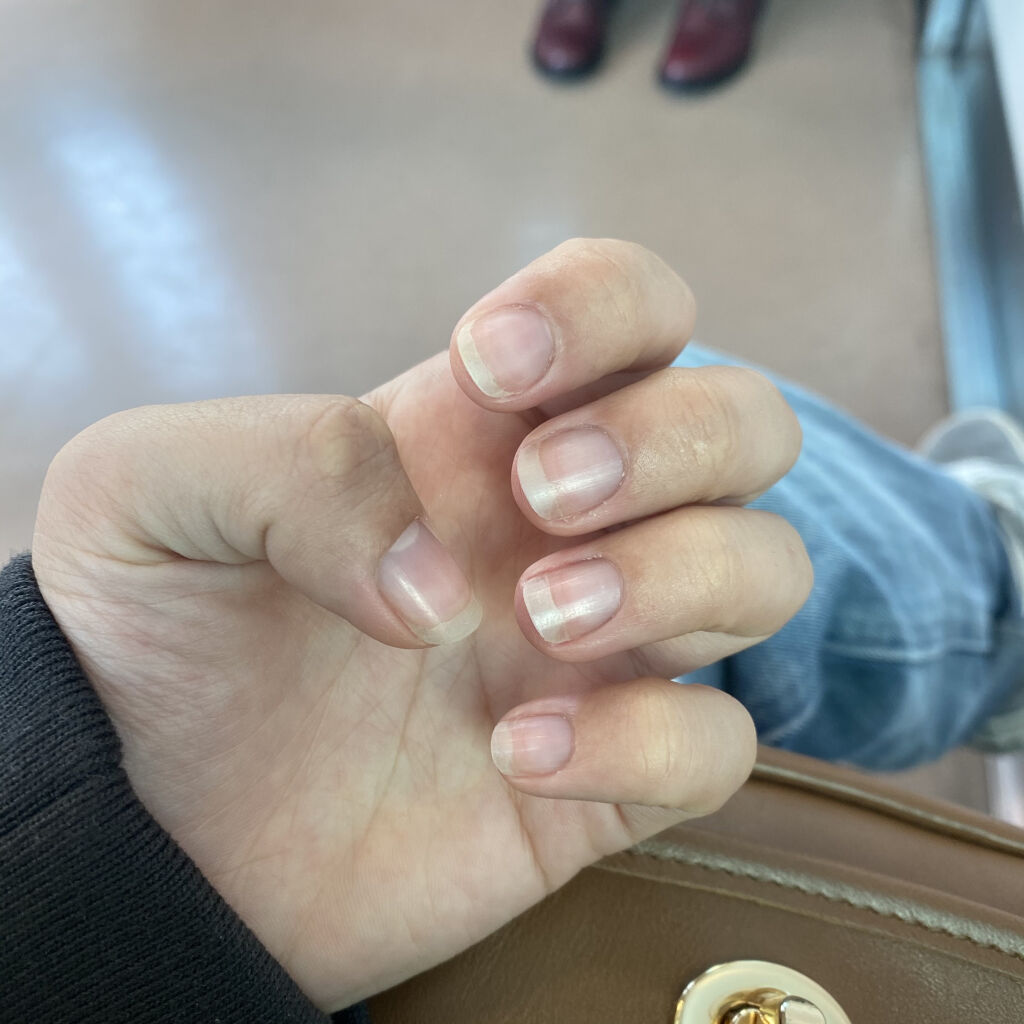 ネイルベッドオイル/アンドネイル/ネイルオイル・トリートメントを使ったクチコミ（2枚目）