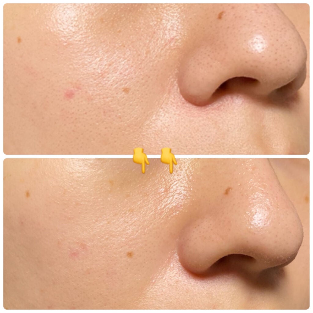 デュオ ザ クレンジングバーム クリア/DUO/クレンジングバームを使ったクチコミ(4枚目)