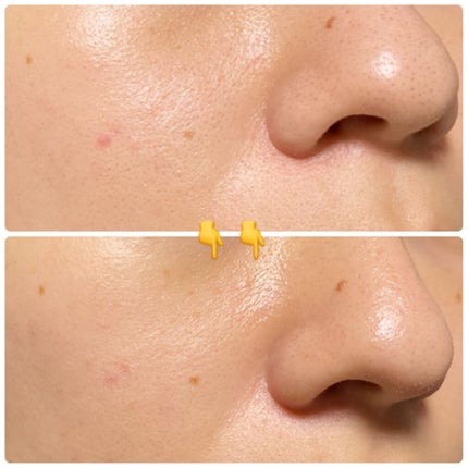 デュオ ザ クレンジングバーム クリア/DUO/クレンジングバームを使ったクチコミ(4枚目)