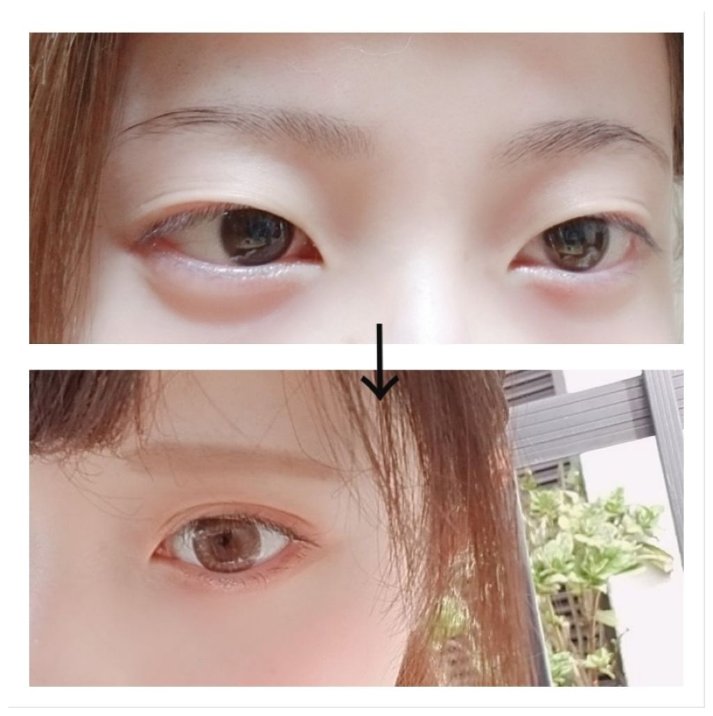 【旧品】オリシキ アイリッドスキンフィルム/D-UP/二重まぶた用アイテムを使ったクチコミ(1枚目)