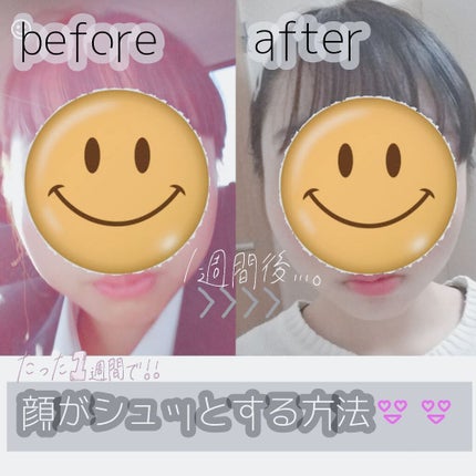 フェイスローラー/DAISO/ボディグッズを使ったクチコミ(1枚目)