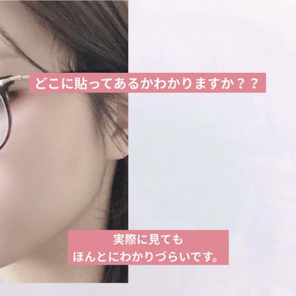 ゼロスポットパッチ/Today’s Cosme/にきびパッチを使ったクチコミ(2枚目)