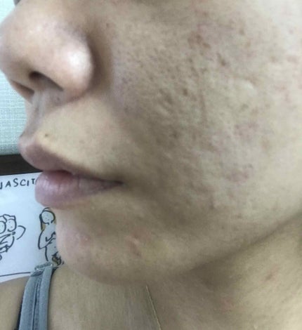 を使ったクチコミ(2枚目)