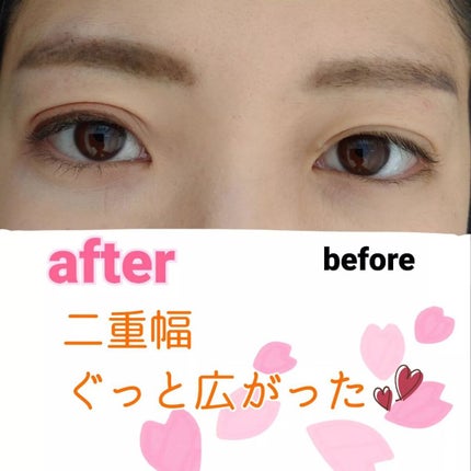 メザイク クリップ カッター ファイバー専用カッター/メザイク/二重まぶた用アイテムを使ったクチコミ(3枚目)