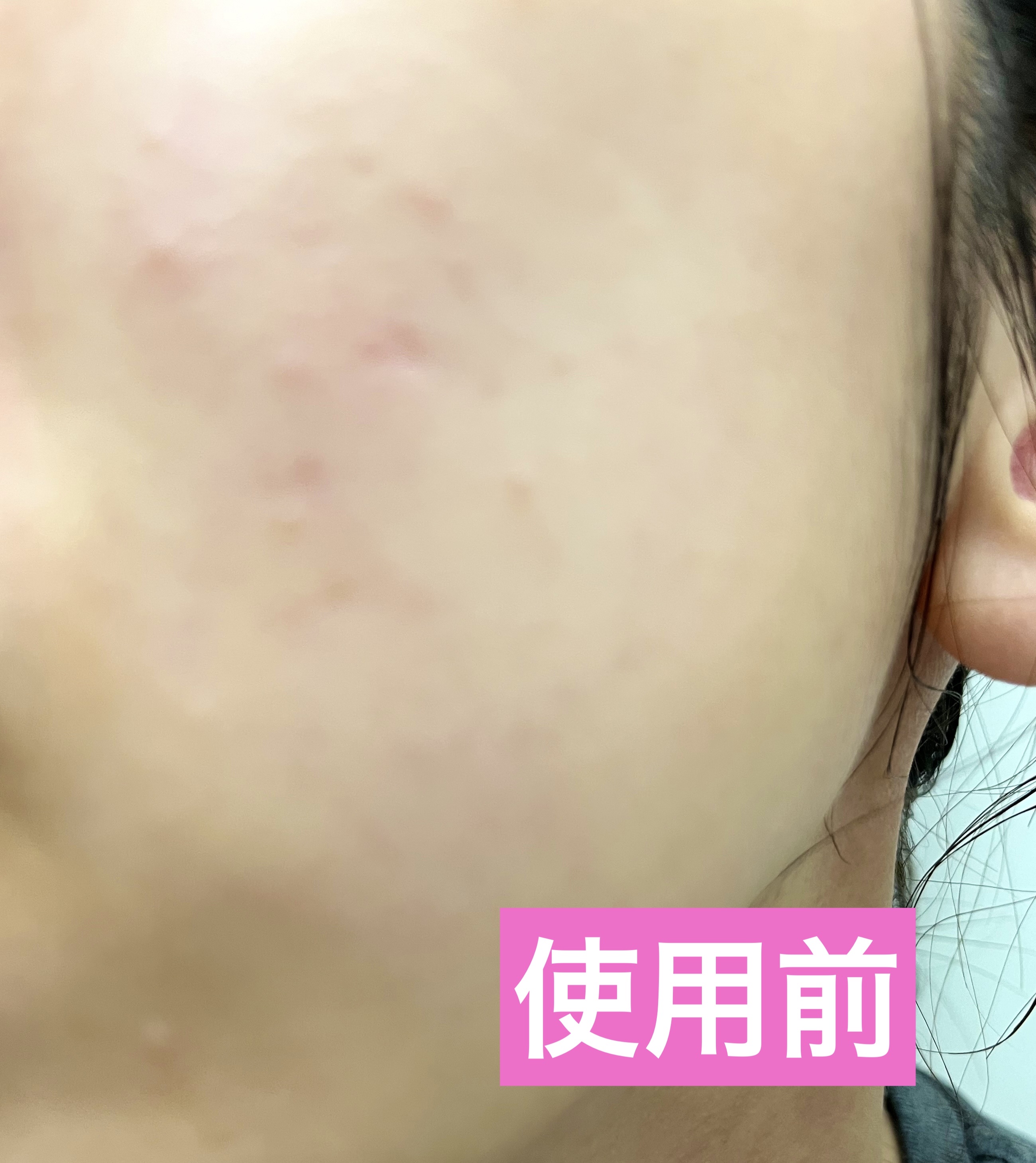 ルルルン ハイドラ EX マスク/ルルルン/シートマスク・パックを使ったクチコミ（2枚目）