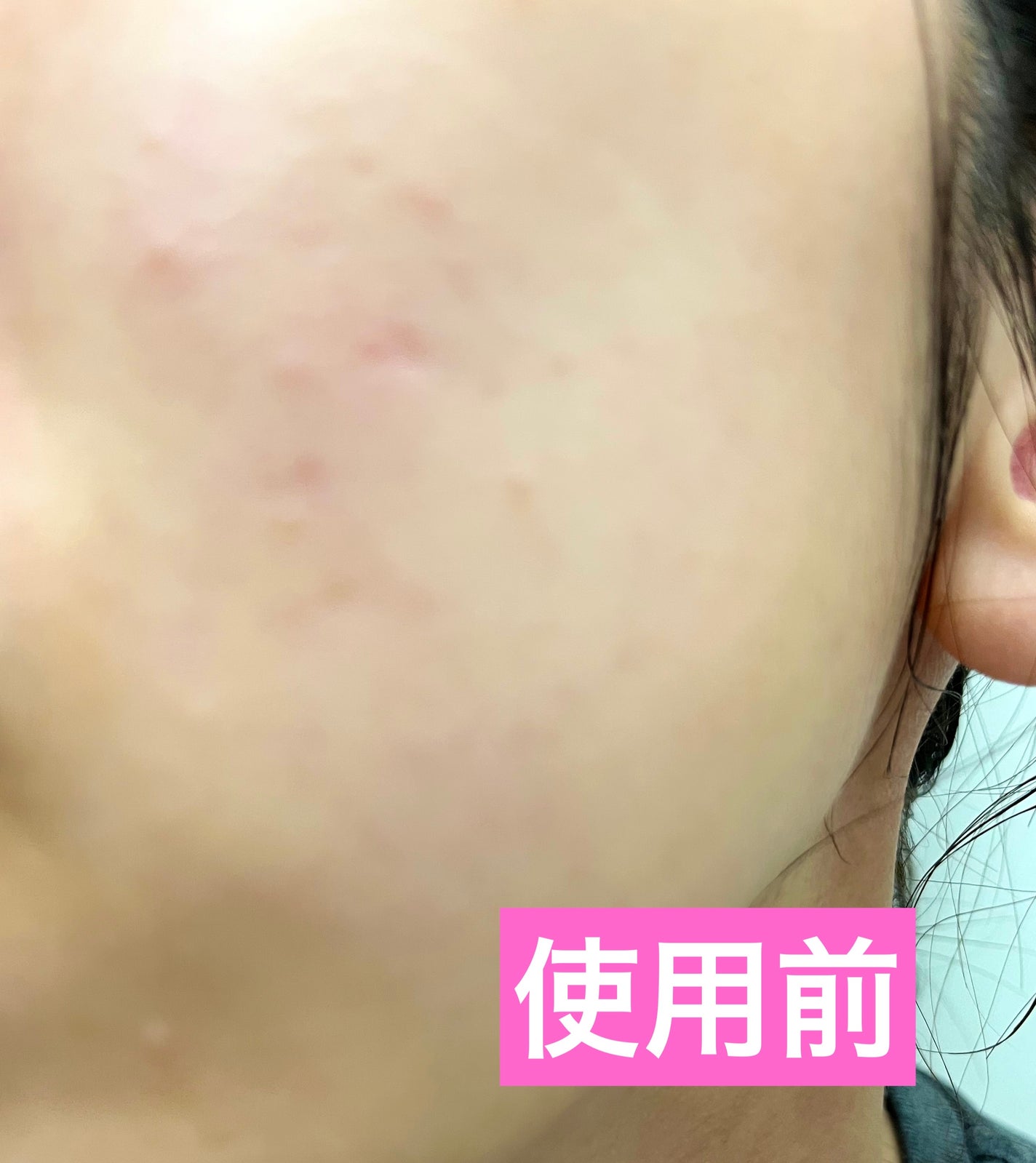 ルルルン ハイドラ EX マスク/ルルルン/シートマスク・パックを使ったクチコミ(2枚目)